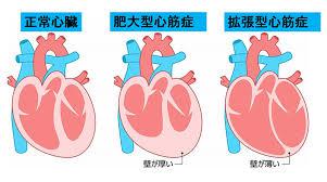 原因