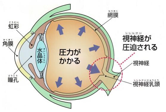 原因