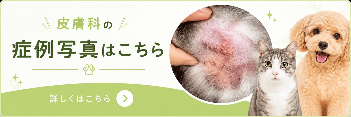 皮膚科の症例写真はこちら